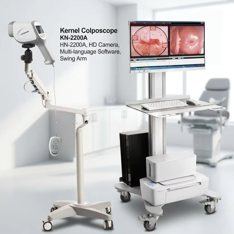CE USA Approved Portable HD Digital Colposcope Gynecology Video System with Electric Power for Cervical Exams