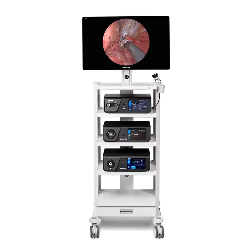 Medical Endoscope Imaging System Tower Laparoscopy Camera Full Set with Trolley for Hospital Surgery